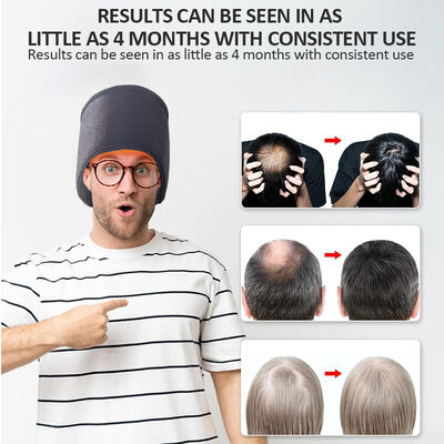 660nm saç büyüme şapkası LED kırmızı ışık tedavisi ve 270 LED kırmızı ışık ve lazer tedavisi şapkası